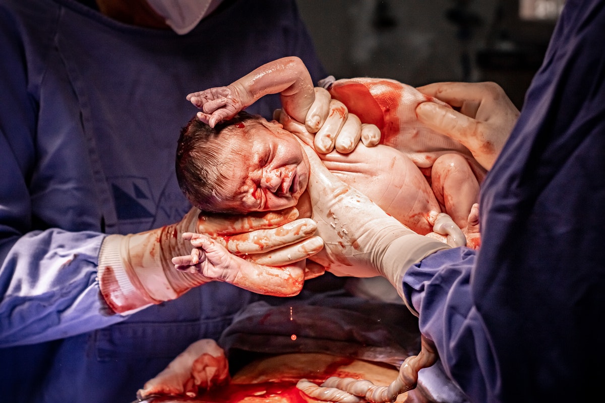 porod-novorozene-miminko
