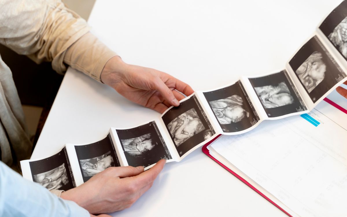 fotky z ultrazvuku